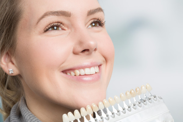 Lächelnde Frau mit verschiedenen Veneers Farben zur Auswahl